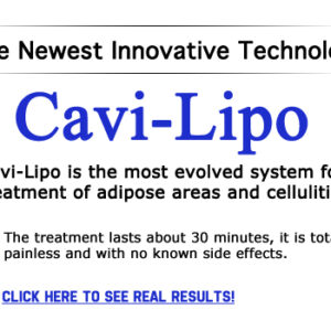 giam beo cavi lipo